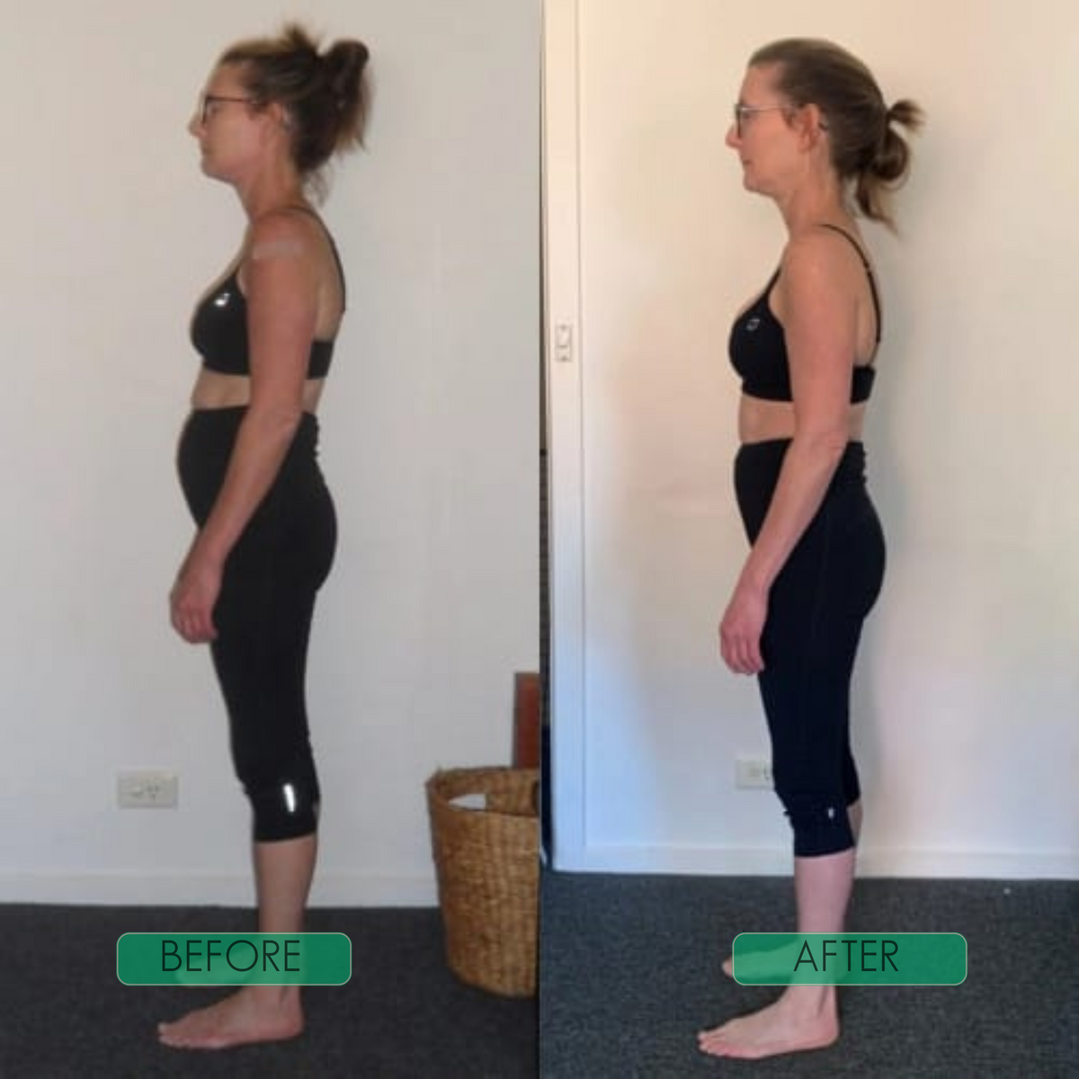 SpineEase™ Posture Corrector for Straighter Everyday Alignment