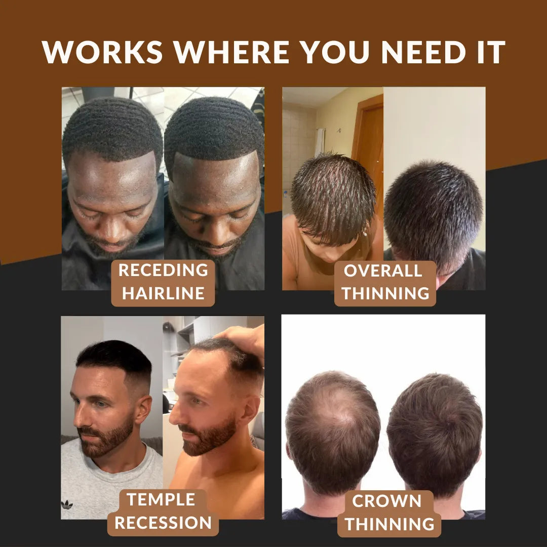 Buy 1, Get 1 FREE | Kerablend™ Mineral Hair Thickening | Instantly fuller hair in 60 seconds