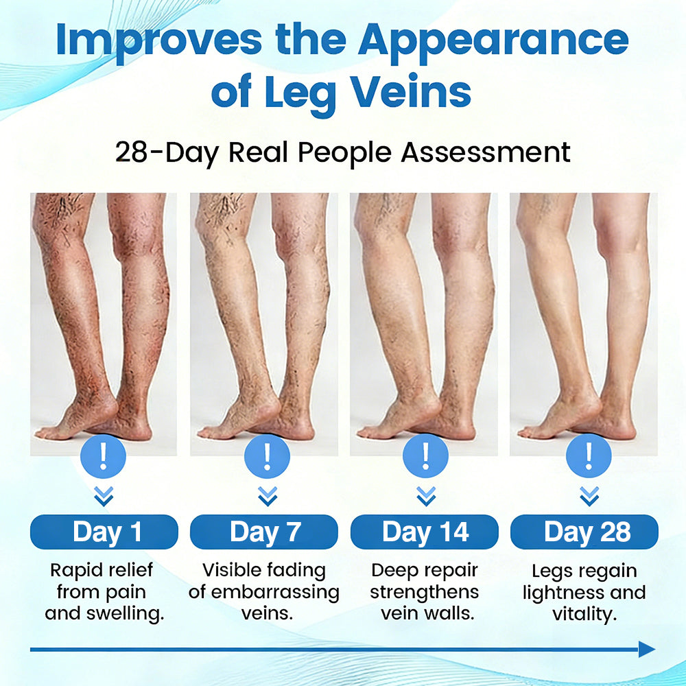 🇦🇺✅✅GFOUK® VascuCare Vein Healing Spray(Designed for Varicose veins, Spider veins, Deep vein Thrombosis, Chronic venous insufficiency, Venous ulcers, Thrombophlebitis and other venous issues)