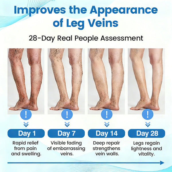 🇦🇺✅✅GFOUK® VascuCare Vein Healing Spray(Designed for Varicose veins, Spider veins, Deep vein Thrombosis, Chronic venous insufficiency, Venous ulcers, Thrombophlebitis and other venous issues)