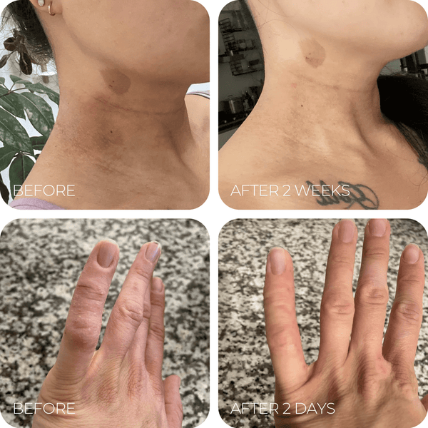 Unscented Tallow Cream™ Soothes Dry Skin with Lasting Hydration