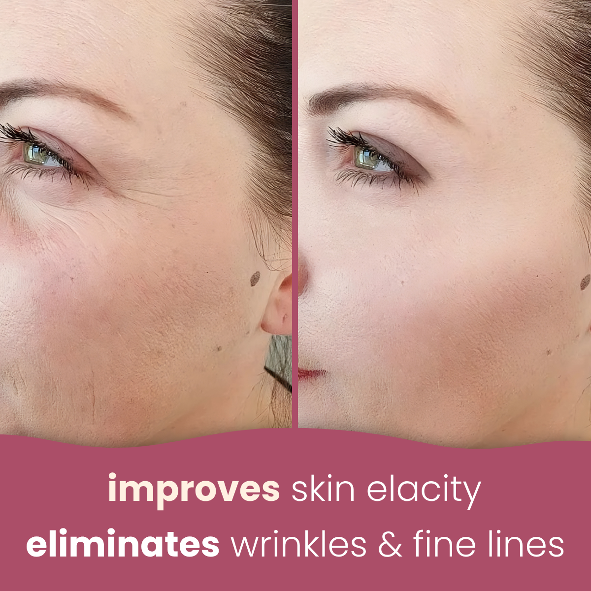 Brightening Turmeric & Kojic acid pads