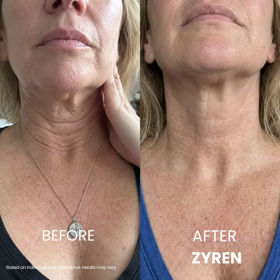 SkinSculpt™ Neck Firming Cream For Youthful Looking Beauty