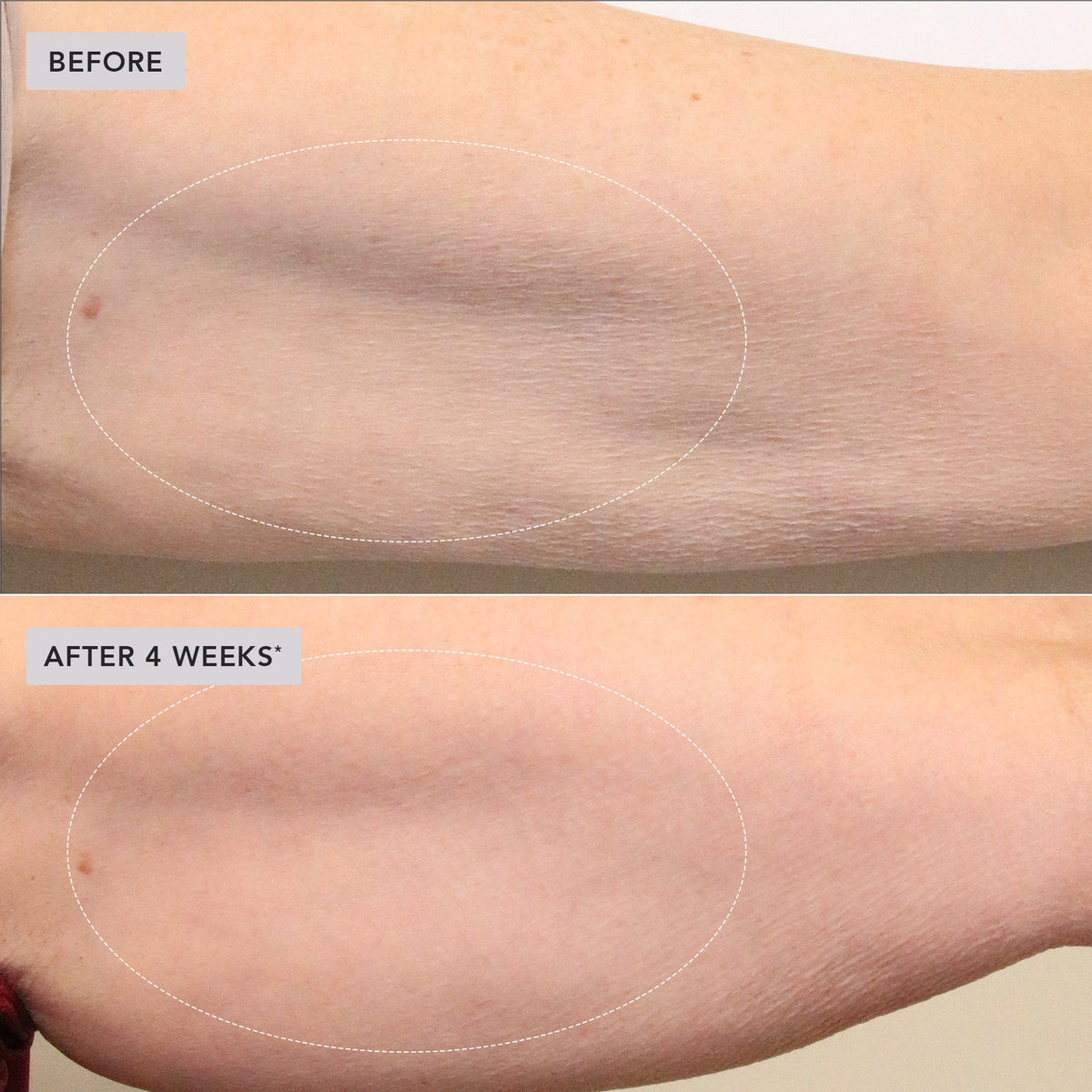 Contourelle™ – Firming body care for a refined silhouette