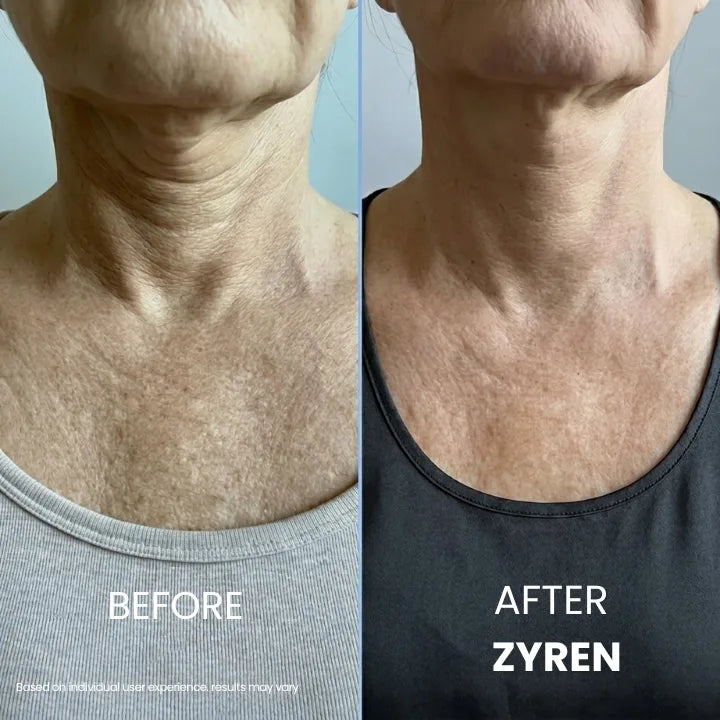 SkinSculpt™ Neck Firming Cream For Youthful Looking Beauty