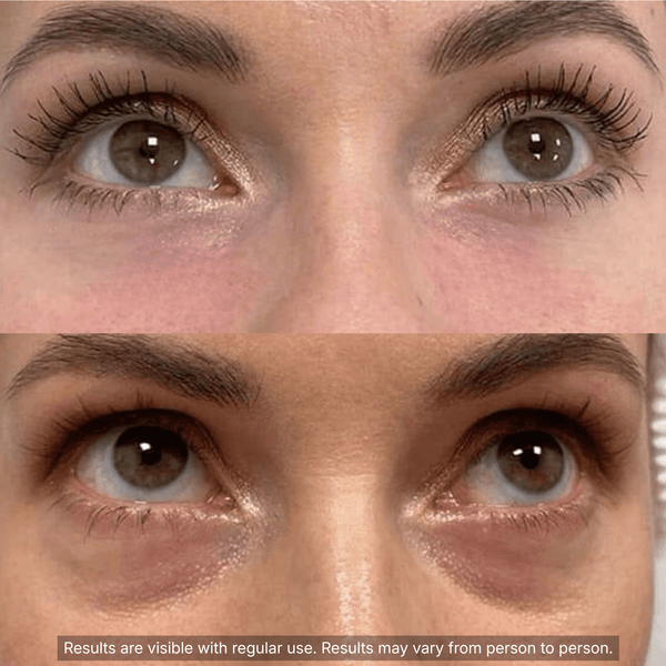 PDRN Collagen Volufiline Multi Balm