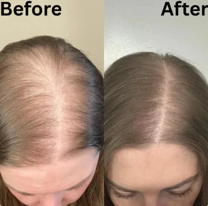 PureRose™ Rosemary Shampoo For Revitalized Healthy Looking Hair