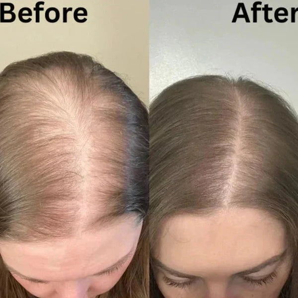 PureRose™ Rosemary Shampoo For Revitalized Healthy Looking Hair