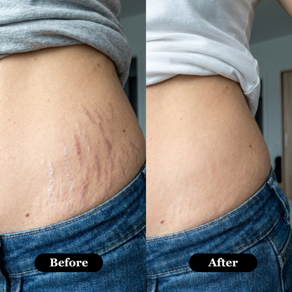 Roviana™ – Retinal Serum for Smooth, Radiant-Looking Skin