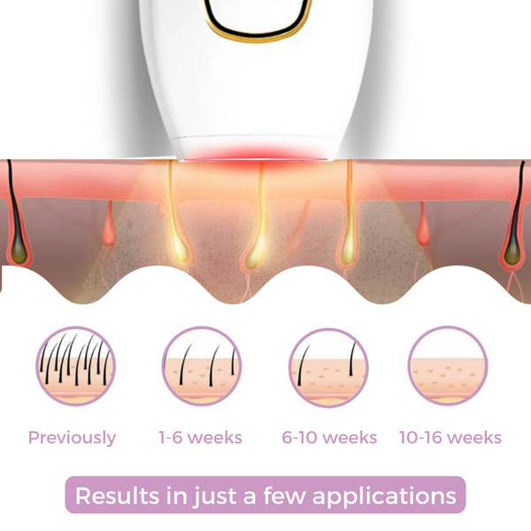 LumaGlow™ | The Ultimate At-Home Laser Hair Removal Solution