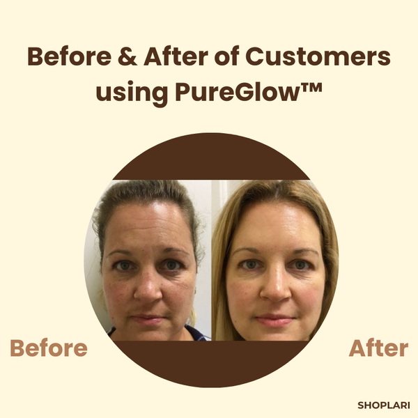 PureGlow™ TeaTherapy Soothing Skin Relief in just Few Weeks