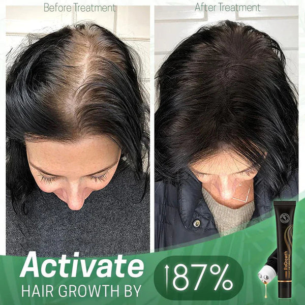 StrandSurge Serum — Ignite Your Hair’s Fierce, Unstoppable Power and Shine