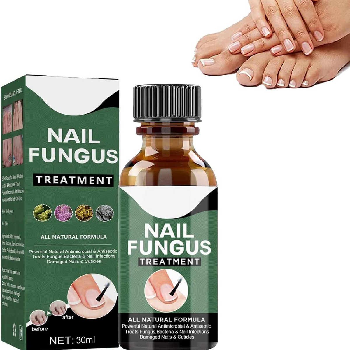 PureNail™ – Nagelpilz-Reparaturserum, heilt, restauriert & schützt beschädigte Nägel effektiv [50% Rabatt]