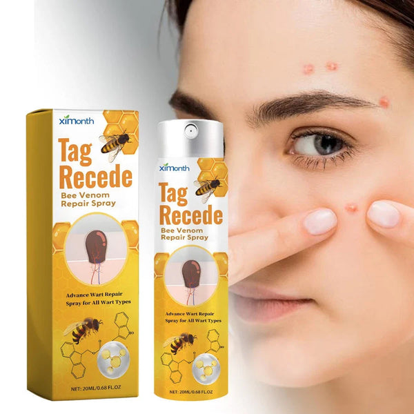 TagAway™ – Effektive Entfernung von Warzen und Hautwucherungen schnell und sicher [50% Rabatt]
