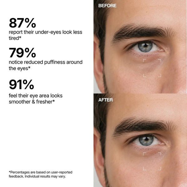 GlowEyes™ – Eye care serum for a radiant, fresh look