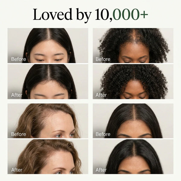 Korean Scalp Revival Bar for Deep Nourishing Hair Care