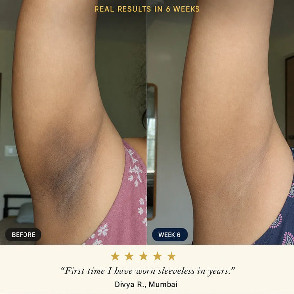 UnderLuxe™ Daily Underarm Cream for Smooth Radiance