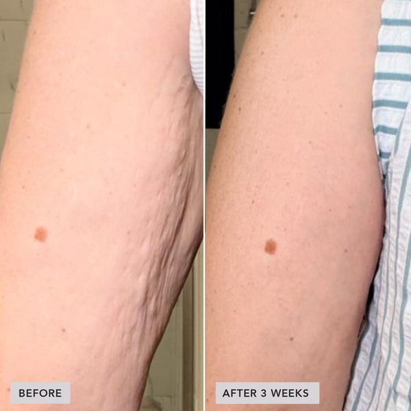 Contourelle™ – Firming body care for a refined silhouette