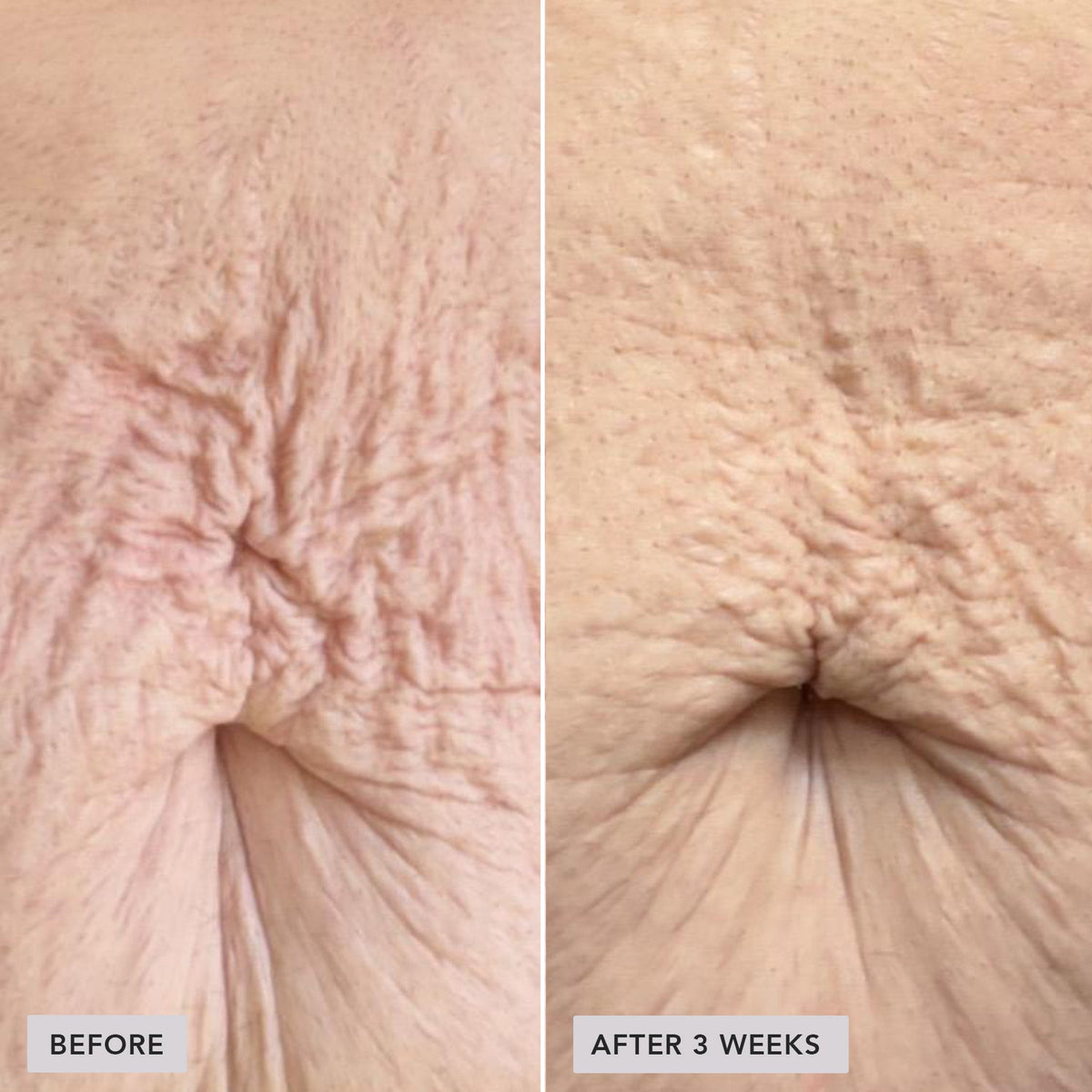Contourelle™ – Firming body care for a refined silhouette