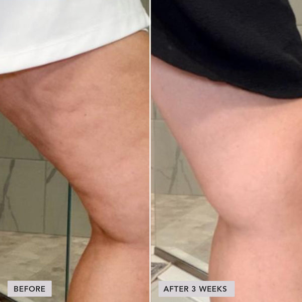 Contourelle™ – Firming body care for a refined silhouette