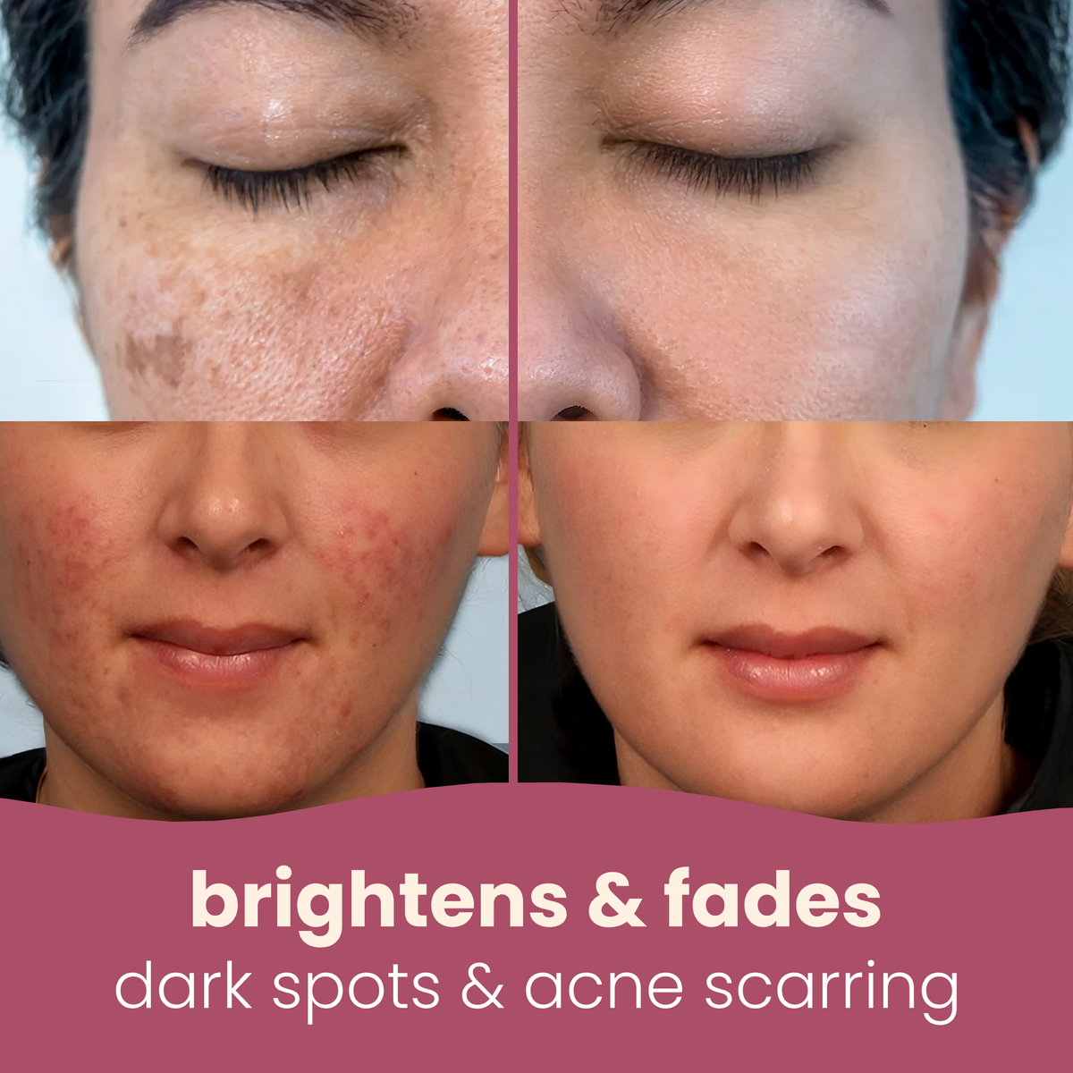 Brightening Turmeric & Kojic acid pads
