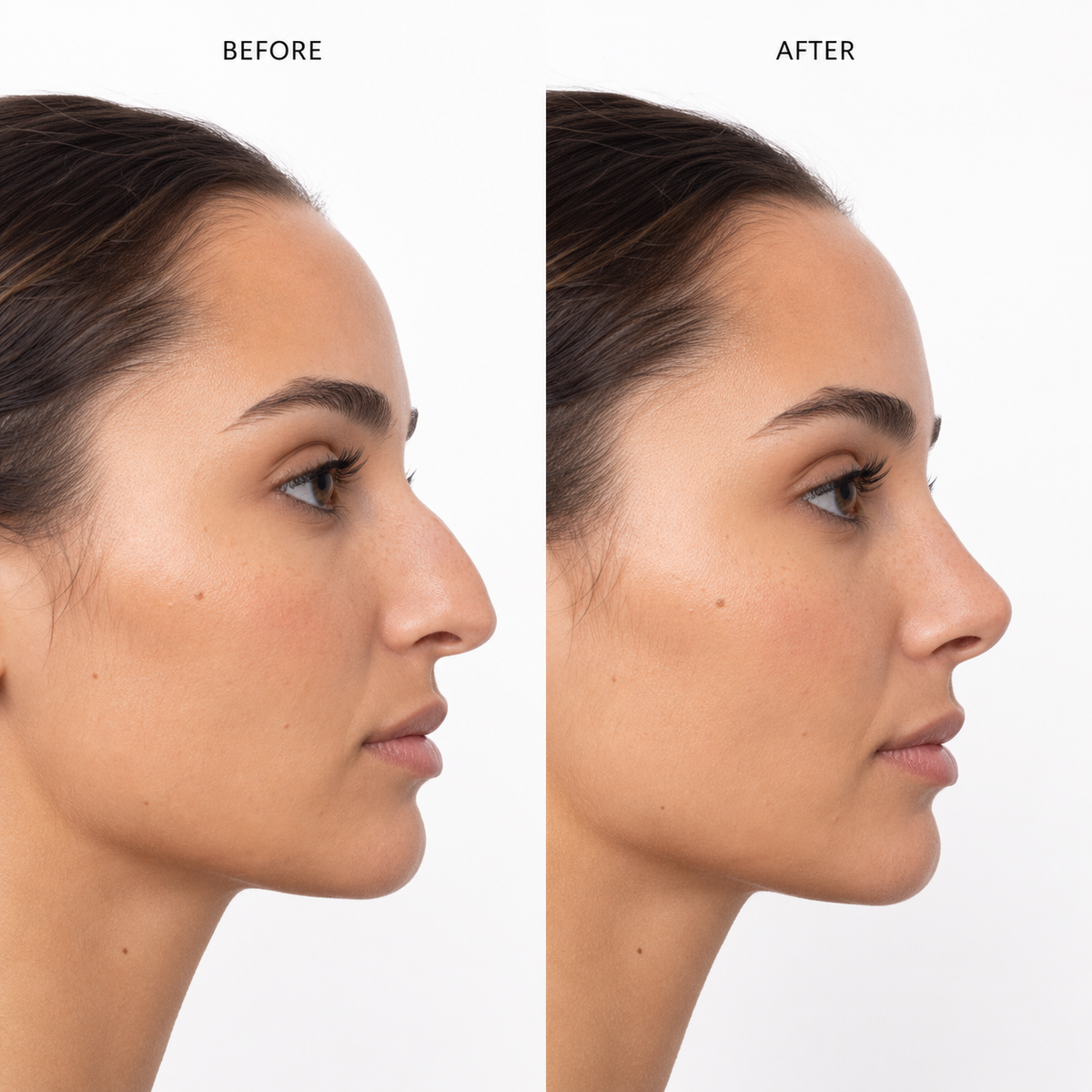 Velixa Nose Sculpting Device