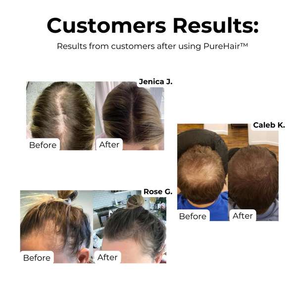 PureHair™ – Natürliches Haarwuchsöl kräftigend, pflegend, stimulierend und revitalisierend [1 + 1 Gratis]