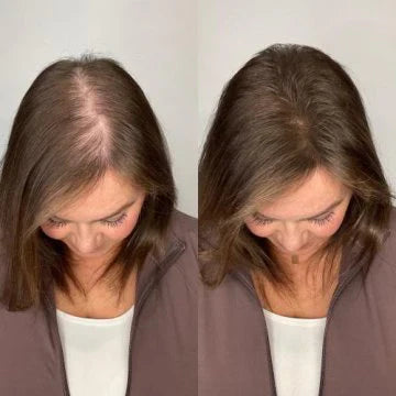 PureRose™ Rosemary Shampoo For Revitalized Healthy Looking Hair