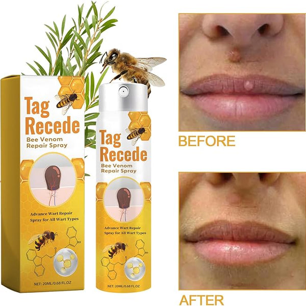 TagAway™ – Effektive Entfernung von Warzen und Hautwucherungen schnell und sicher [50% Rabatt]