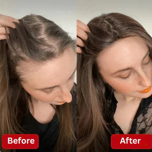 PureRose™ Rosemary Shampoo For Revitalized Healthy Looking Hair