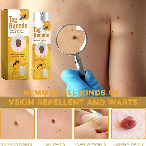 TagAway™ – Effektive Entfernung von Warzen und Hautwucherungen schnell und sicher [50% Rabatt]