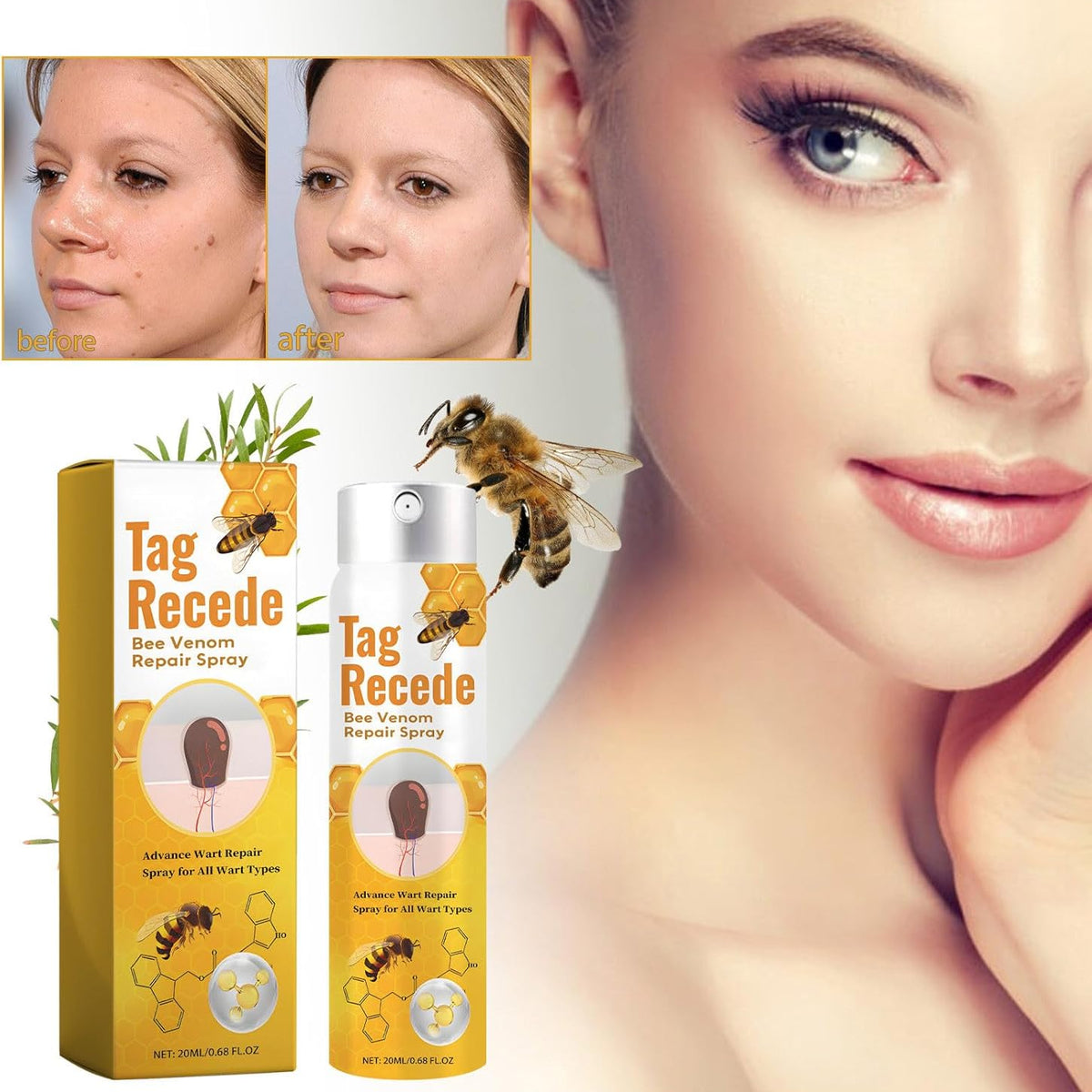 TagAway™ – Effektive Entfernung von Warzen und Hautwucherungen schnell und sicher [50% Rabatt]