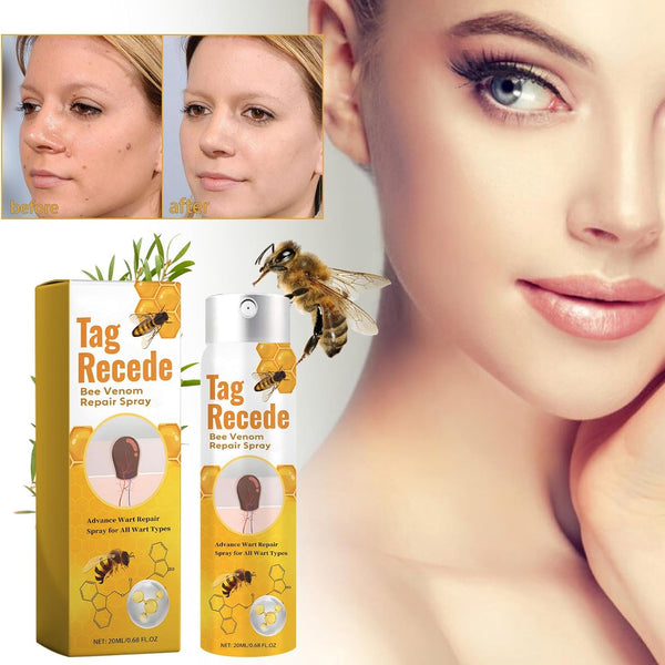 TagAway™ – Effektive Entfernung von Warzen und Hautwucherungen schnell und sicher [50% Rabatt]
