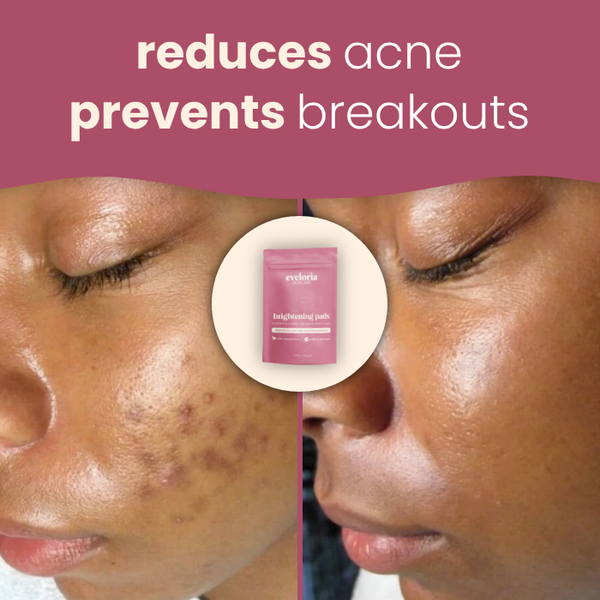 Brightening Turmeric & Kojic acid pads